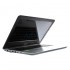 Asus K556UQ-XX688T (Dark Blue)